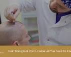 hair transplant cost