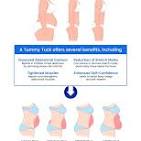 abdominoplasty cost