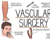 vascular surgeries